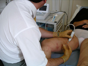 Ultrasound Guided Sclerotherapy Michael Gaunt